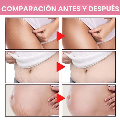 Adeus Crema Brasileña Antiestrías y Reafirmante 300g | Hidratación Intensiva para una Piel Más Lisa y Elástica