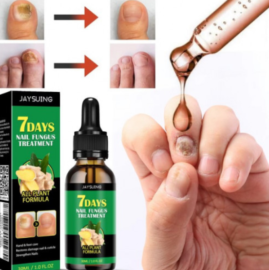 JAYSUING 7 Days Tratamiento para Uñas 30ml | Cuidado para Uñas de Pies y Manos