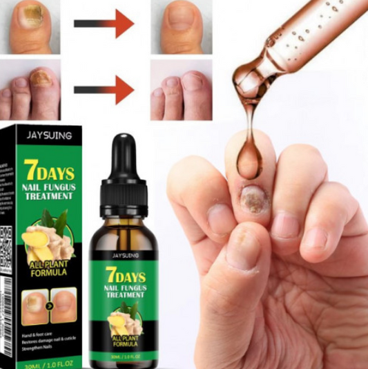 JAYSUING 7 Days Tratamiento para Uñas 30ml | Cuidado para Uñas de Pies y Manos