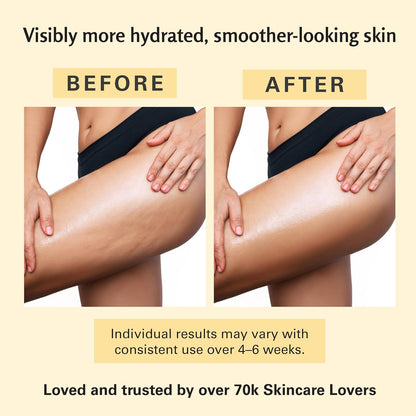 M3 Naturals Aceite Anticelulítico y Antiestrías con Colágeno | Aceite Reafirmante para Masajes Corporales